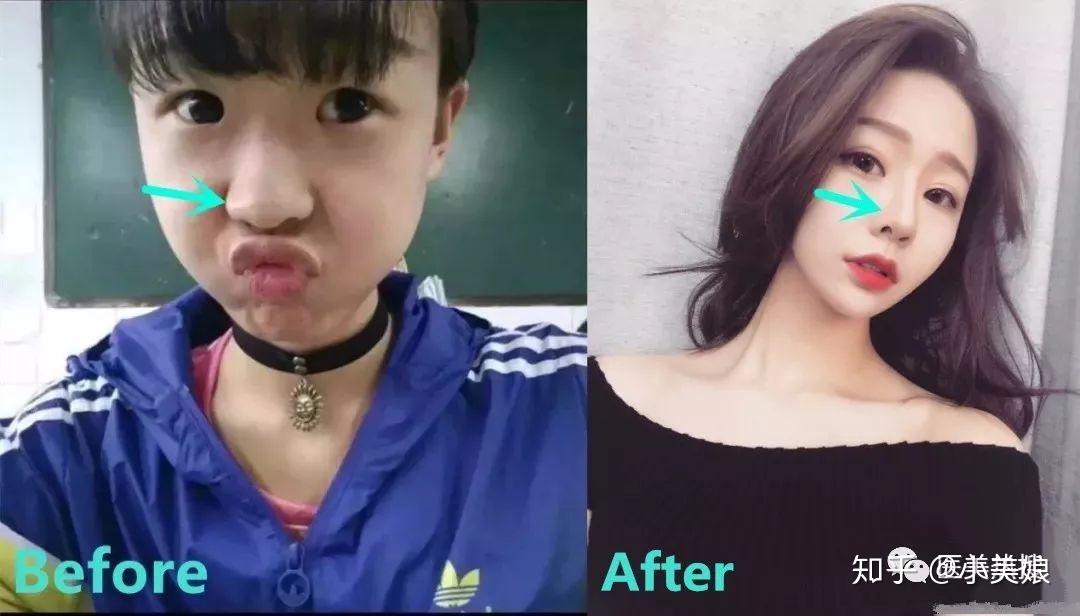 刚火就被封的d音女神温婉14岁整容傍金主改变命运