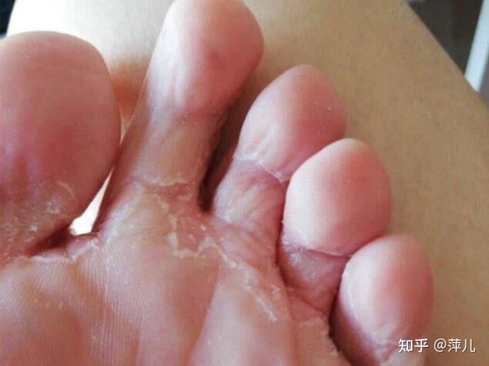 女生脚臭是种什么样的体验? 