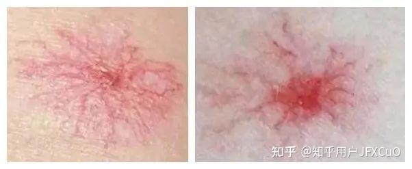 气不顺 血就瘀，教你如何识别气滞血瘀 - 知乎