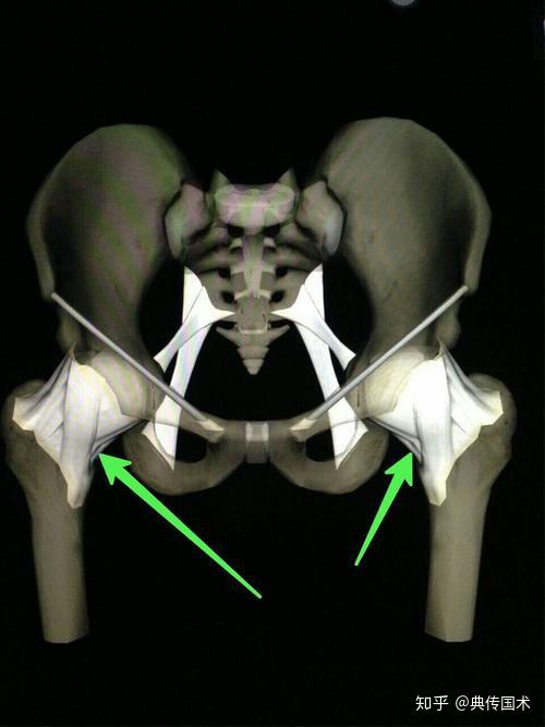 典传筋骨体系构成