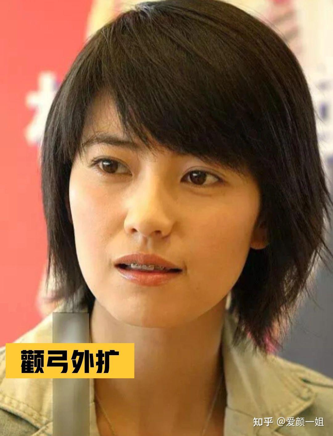 内推颧骨_颧骨内推推哪里_颧骨内推是怎么推的