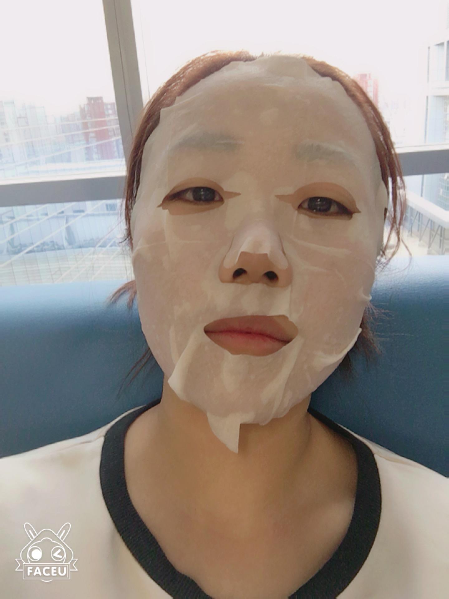 点阵激光 祛痘坑痘印