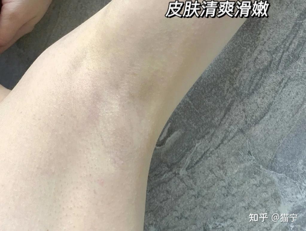 什么牌子的脱毛膏脱完没有黑点?