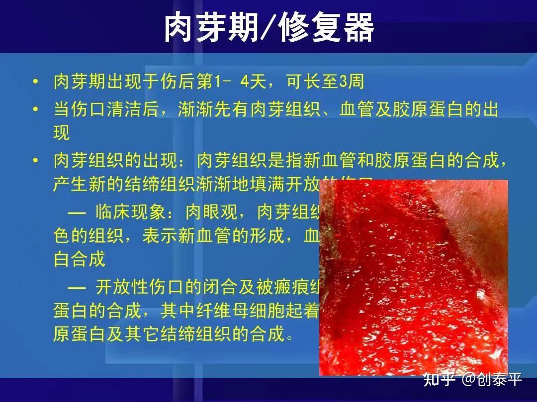 伤口愈合后为什么会留疤？ - 知乎
