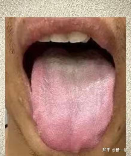 典型的脾肾阳虚,怪不得房事上连三分钟都坚持不了! - 知乎