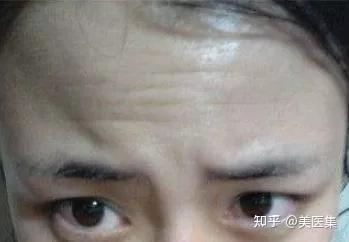 额头有纹的人注意了，你的运势正隐藏其中！ - 知乎