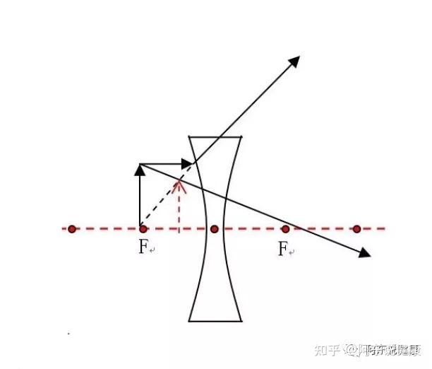 浅谈近视镜是凸透镜还是凹透镜是聚光还是散光