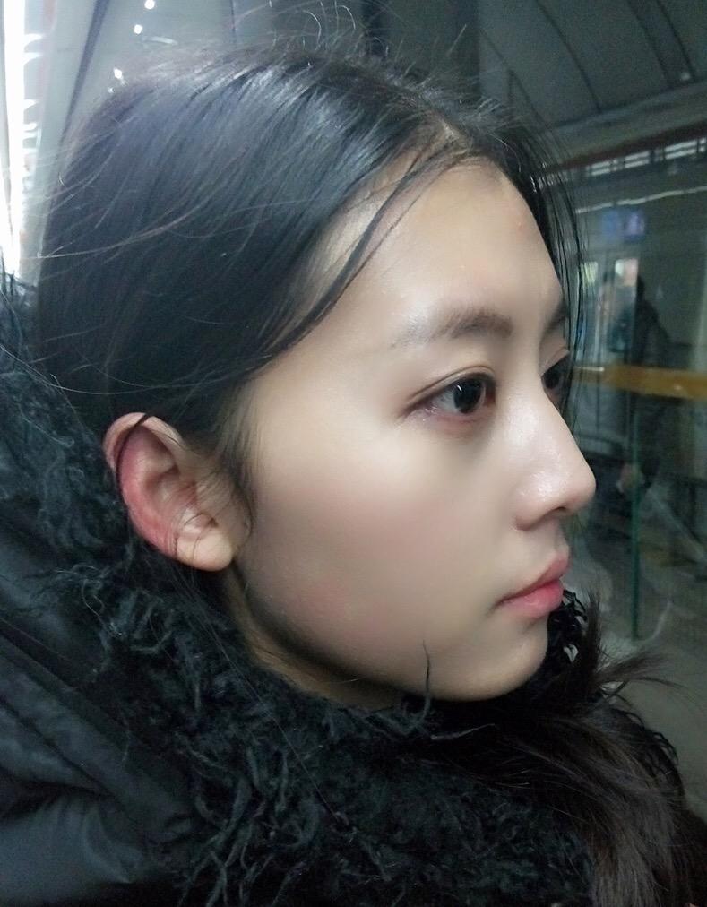 鼻子太挺拔有什么体验?