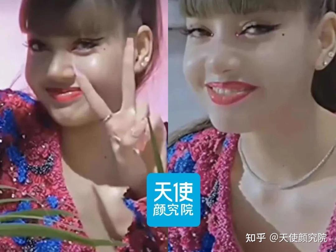 lisa的脸…救命啊，这是吃了200斤鱼头泡饼吗？！ - 知乎