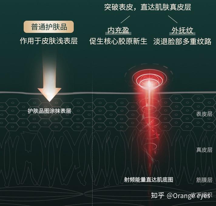 一,射频美容仪原理
