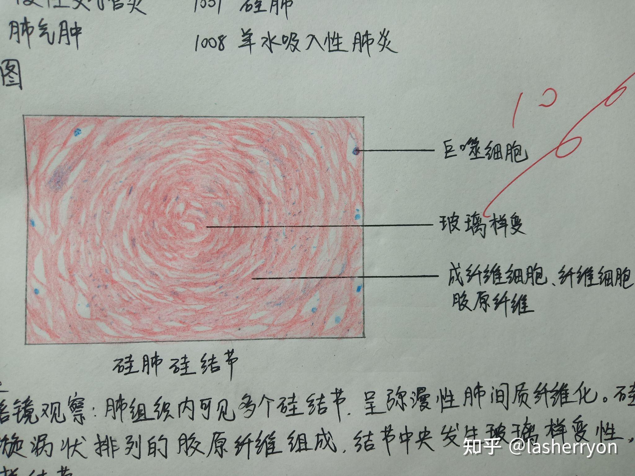 病理红蓝铅笔手绘图