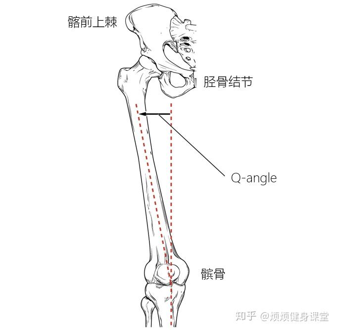 如何改善膝盖内扣
