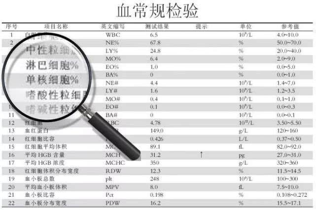 v2-561a8d833affbbf13d24683ce4afe390_1440w.jpg?source=172ae18b