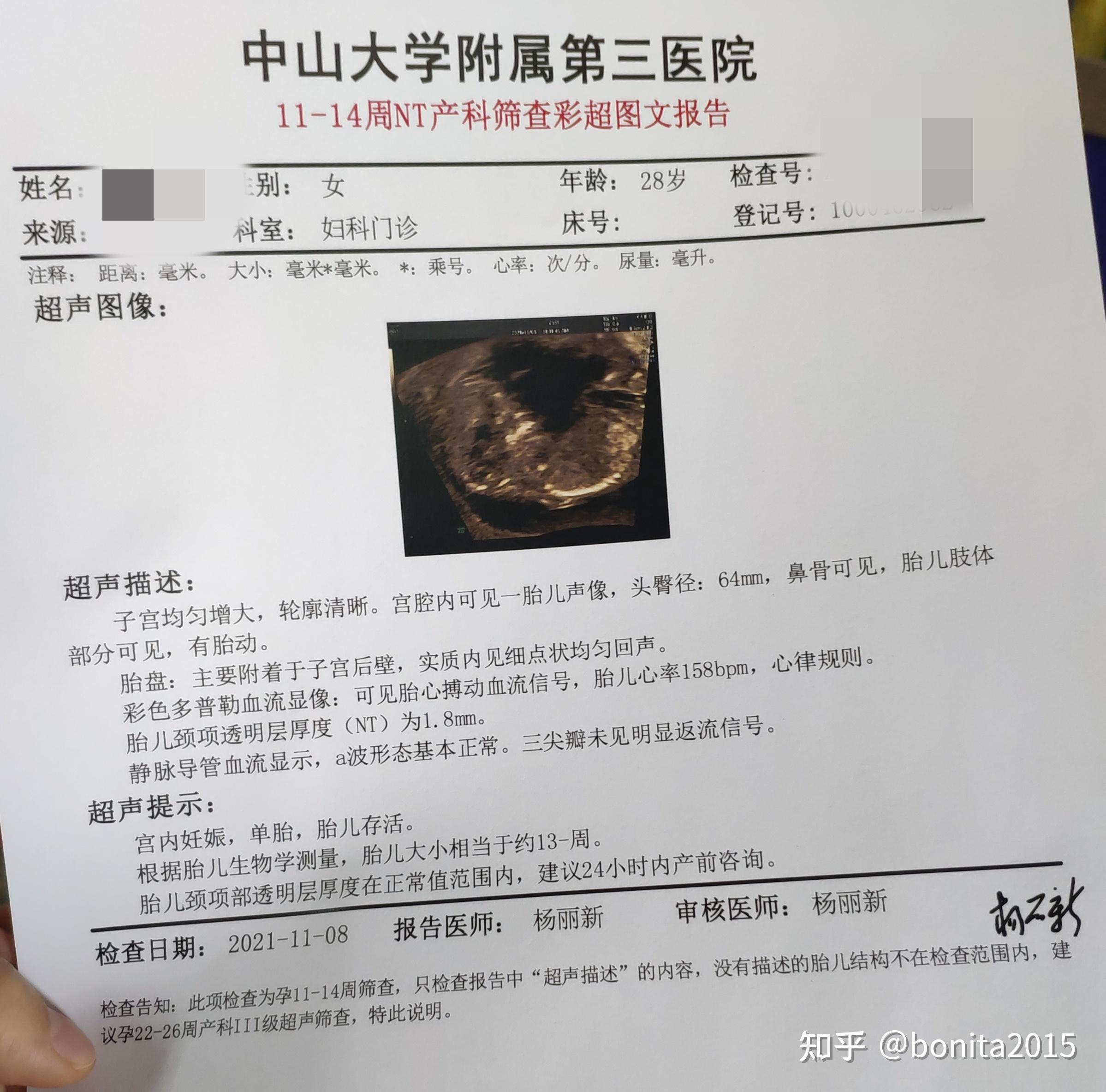 2021年2022年广州产检全流程每月一更已完结