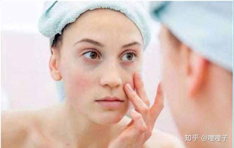 什么是黑头 v2-565392510476fbae9fdb43835b17a4bd_r.jpg