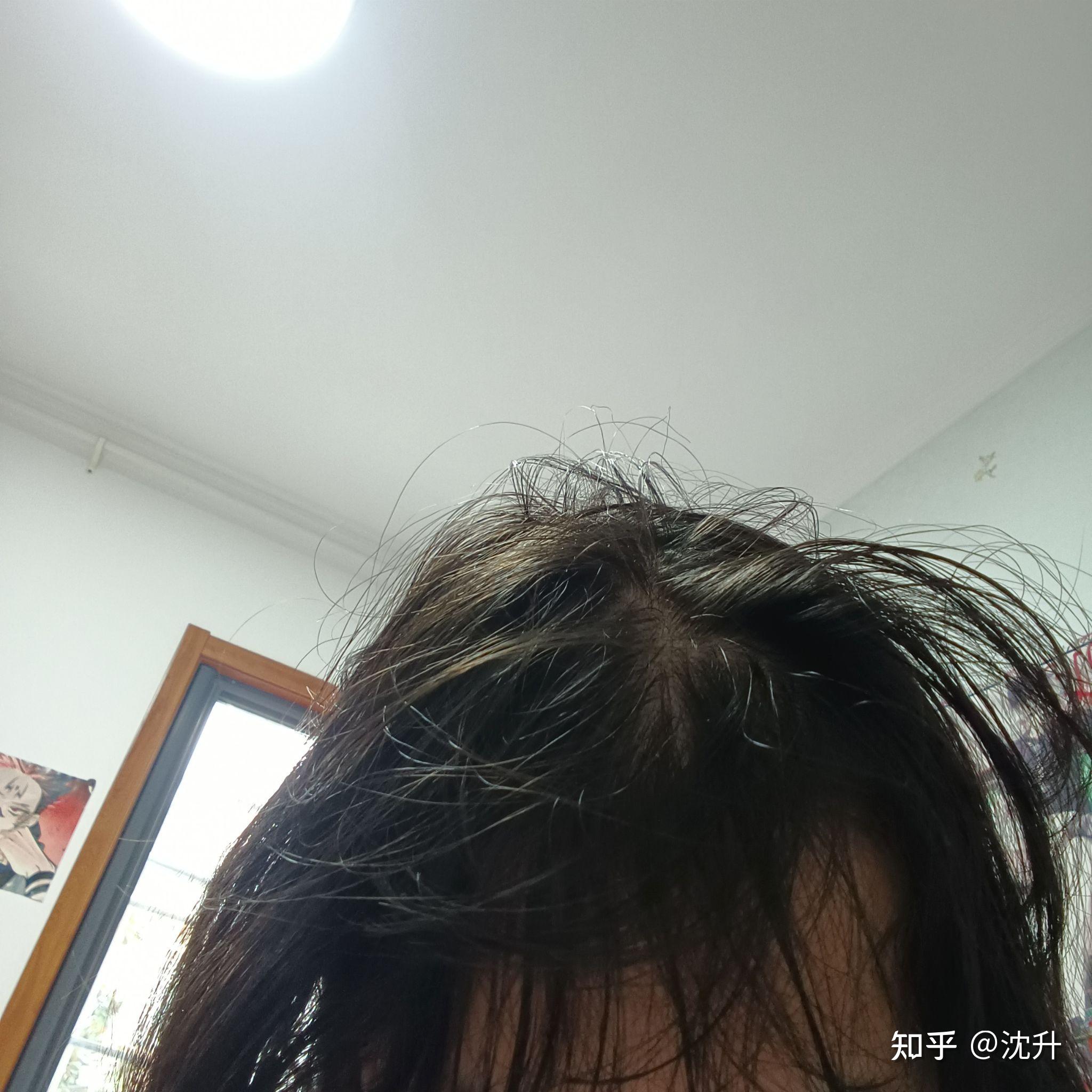头发少怎么办 - 知乎