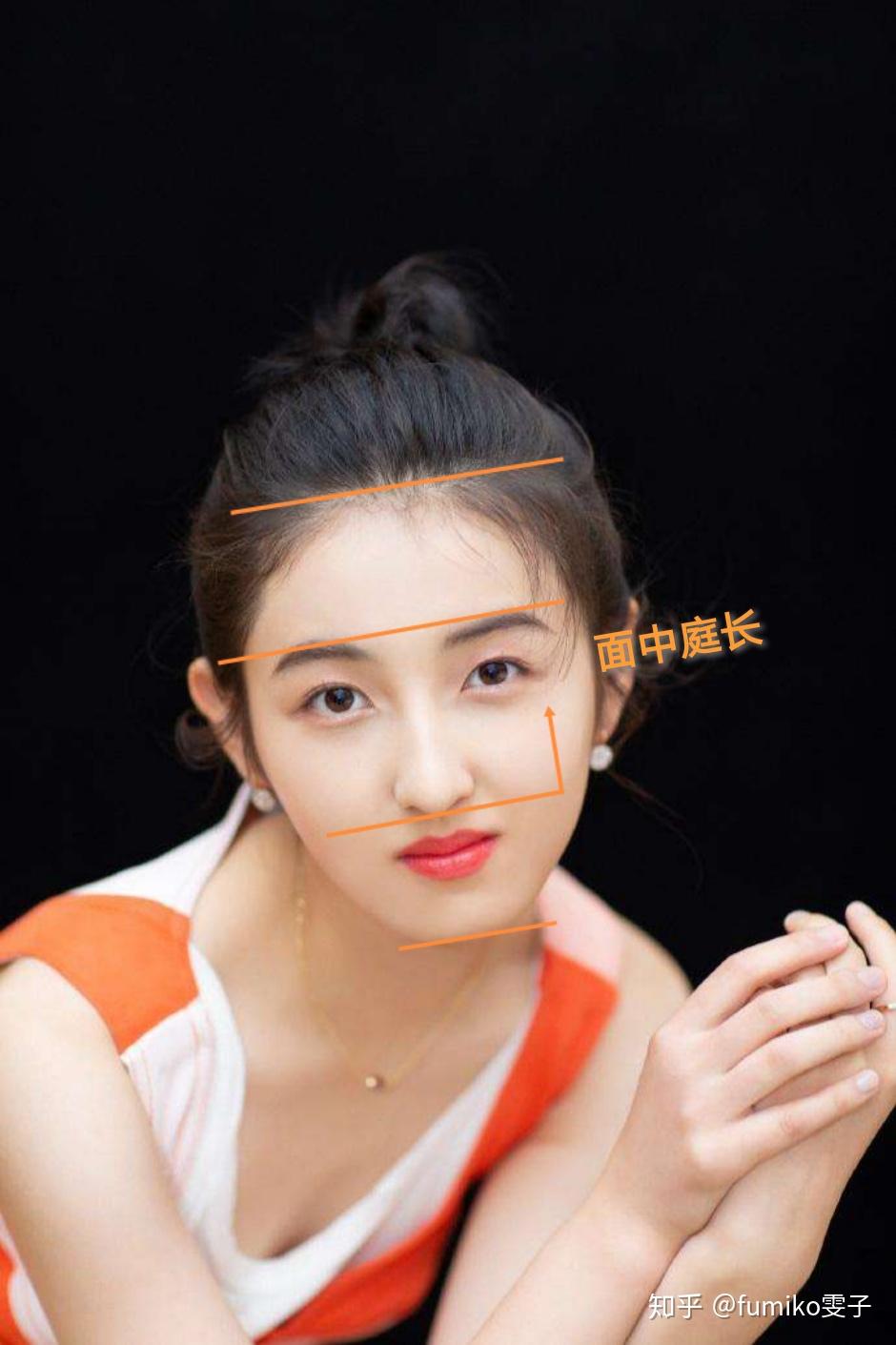 三庭五眼中面中庭(眉弓到鼻底的距离)长度较长,进一步放大了这一优势.