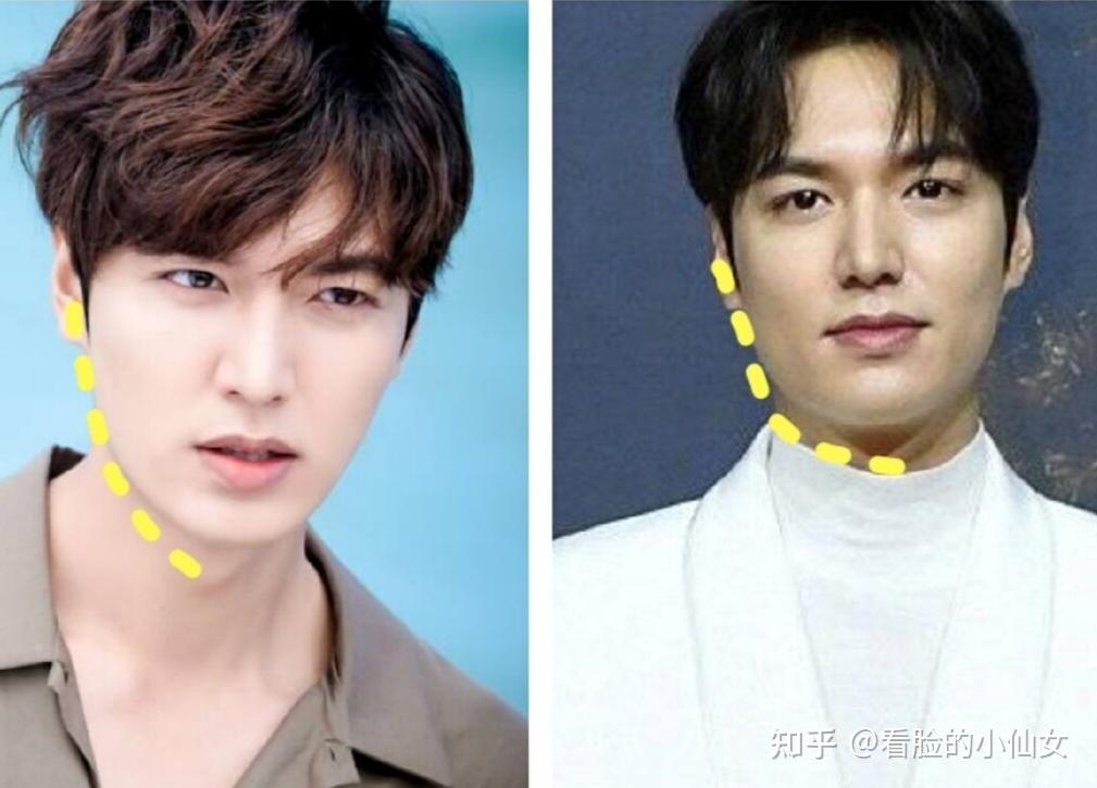 救命难道成年人都逃不过发腮吗发腮了应该怎么办