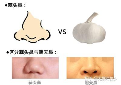 朝天鼻、鼻孔外露你中招了吗? - 知乎