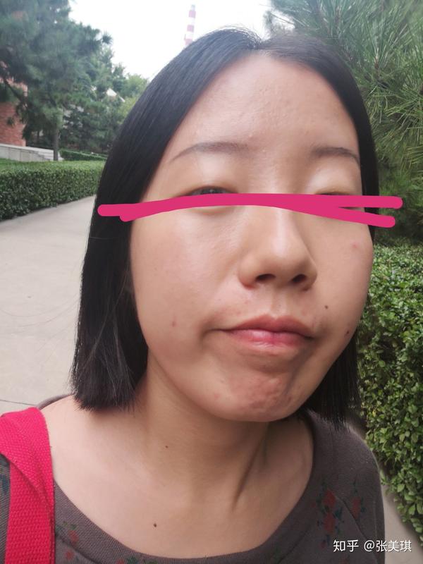 有酒窝钉是一种什么样的体验?