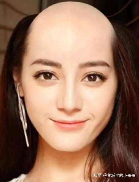 如何看待女性脱发焦虑是男性的三倍为什么女性会比男性