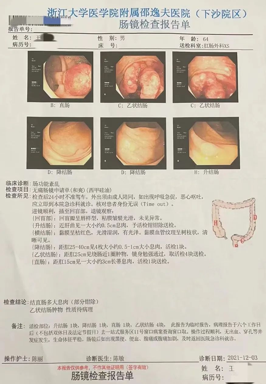 【案例探讨】肠癌高发的年龄段,快看看你中招了吗? - 知乎