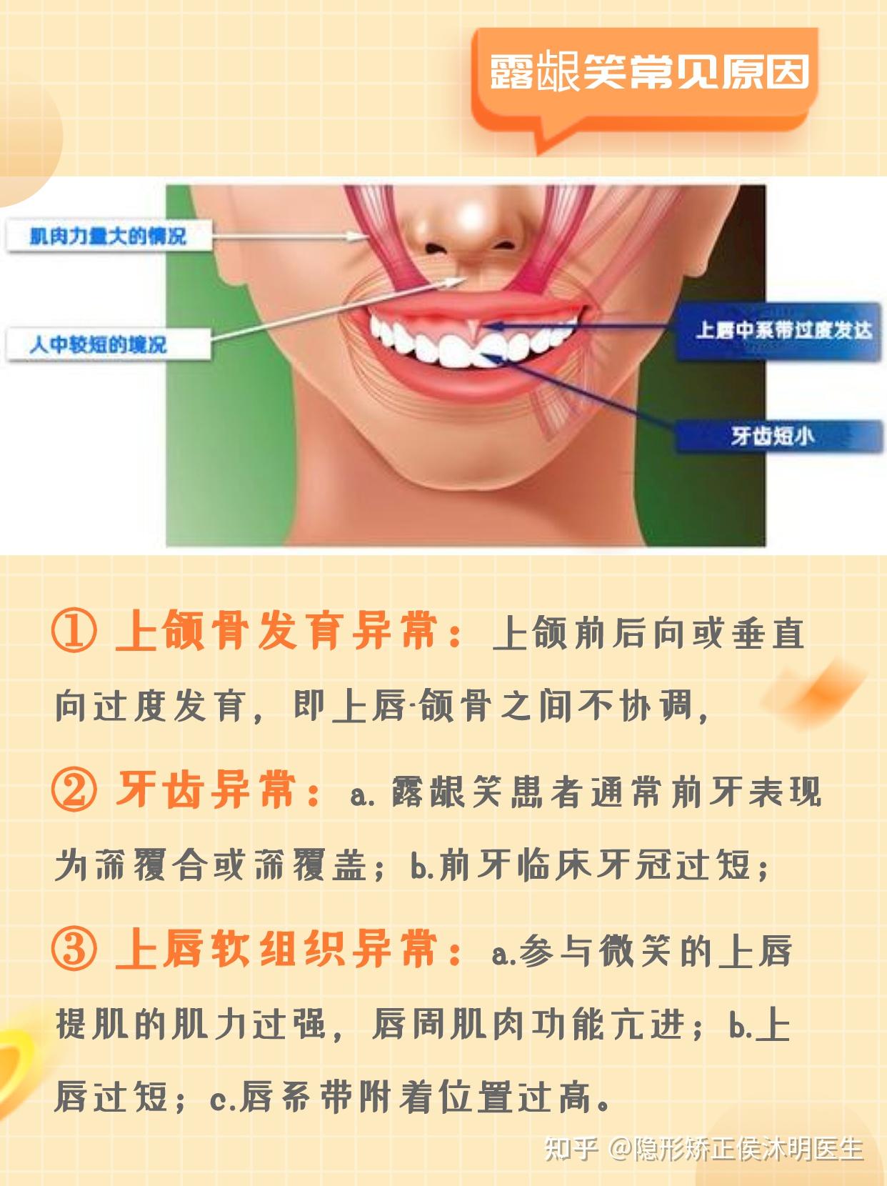 上唇系带正常位置图片图片