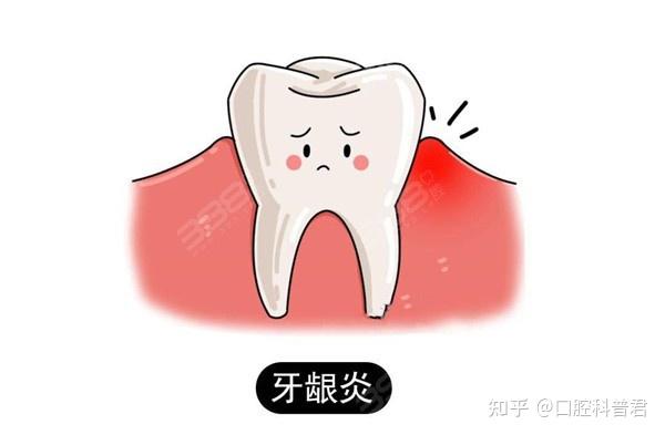 牙龈发炎肿痛怎么办?教你3个小妙招快速止痛 - 知乎