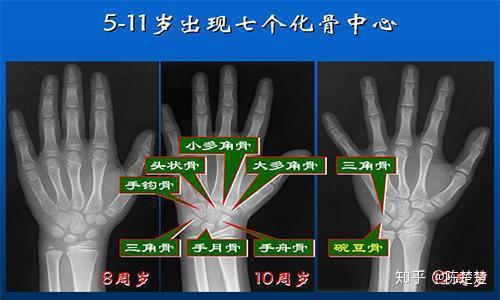 骨骺闭合到底还能不能长高 知乎