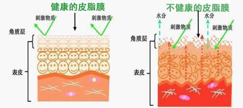 皮肤表皮层家庭的五兄弟之 角质层和皮脂膜 知乎 皮肤表皮层家庭的五兄弟之 角质层和皮脂膜 知乎