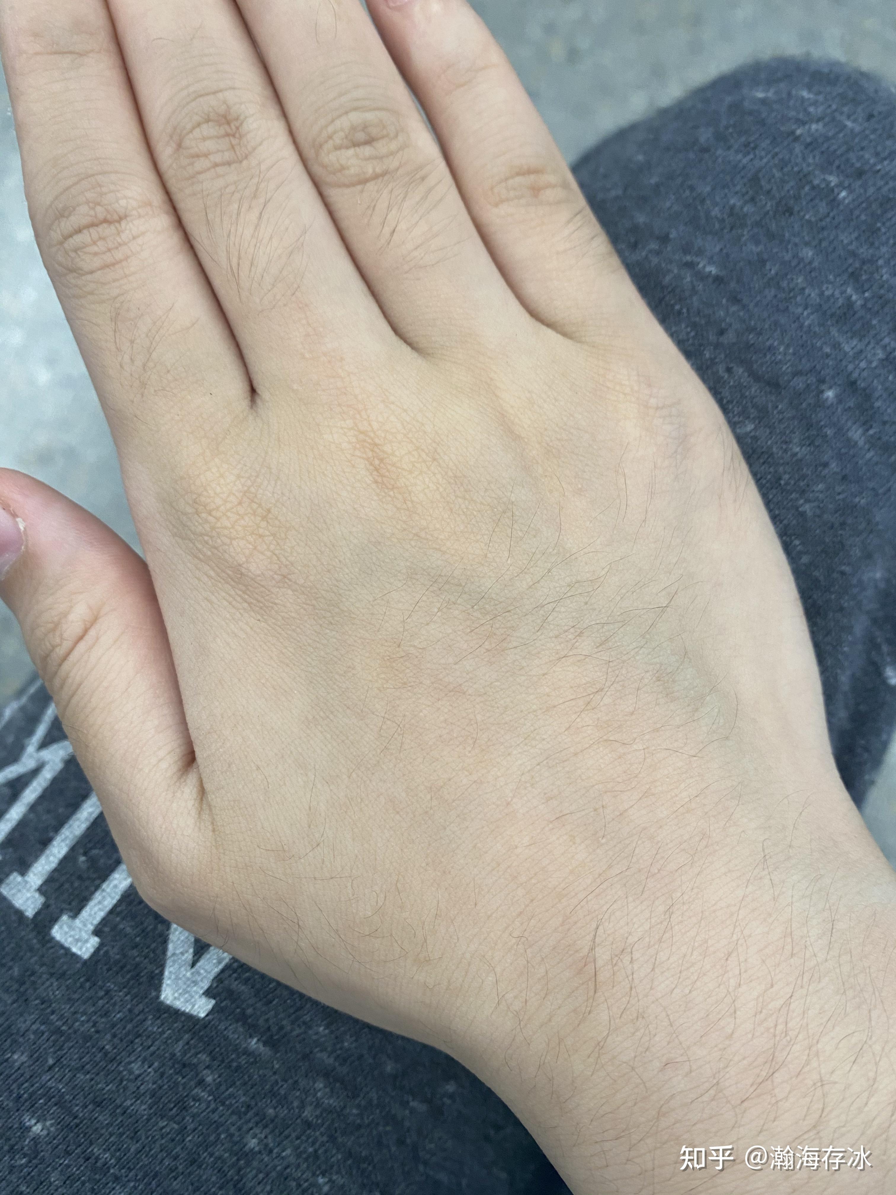 女生长浓密手毛是一种什么样的体验?