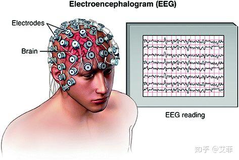 脑科学研究方法二脑电图篇