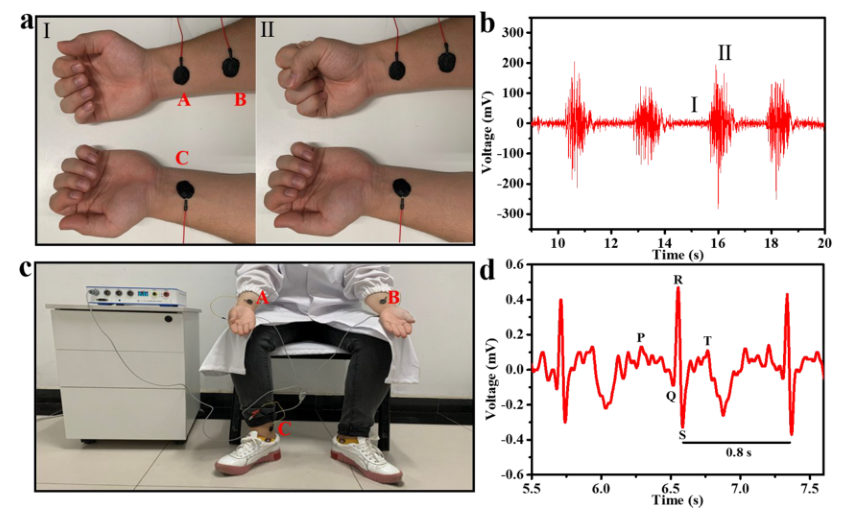 图4 肌电图监测生物相容性验证为了研究mxenepaa-acc水凝胶基表皮
