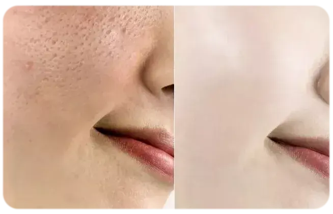 亮白新世代瓷美肌ii从根源解决肤色暗沉无光泽