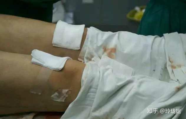 什么减肥药不伤身 v2-589b7e7b1c318ee19dfce9c3c3c9a0cd_r.jpg