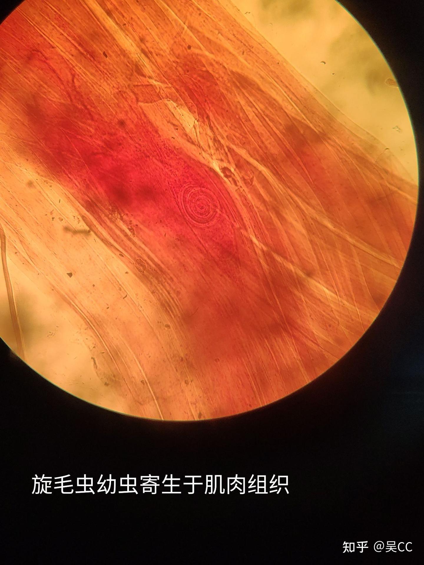 人体寄生虫学实验 - 知乎