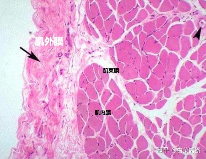 HE染色特征:肌肉 / Muscle - 知乎