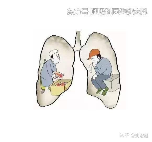 如何预防肺结节最好的办法 v2-58a585664fecc9c6709011e09303c1b5_r.jpg