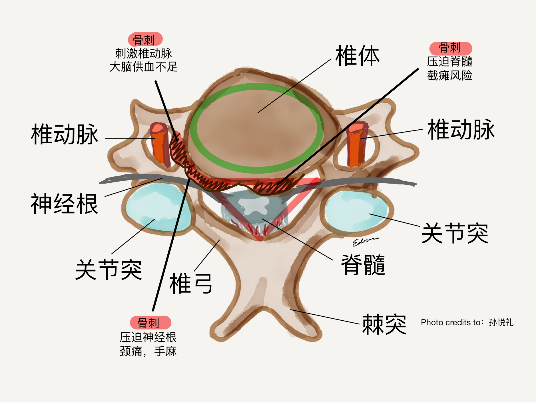 椎骨间的连接结构图图片