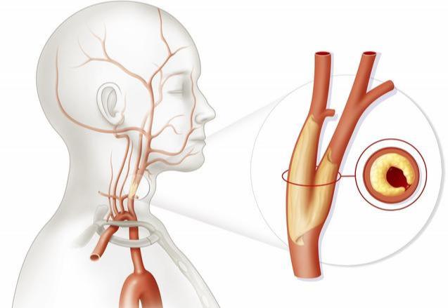 怎么样才可以长内膜 v2-58b129316593c227b8a7d92181206456_1440w.jpg?source=172ae18b