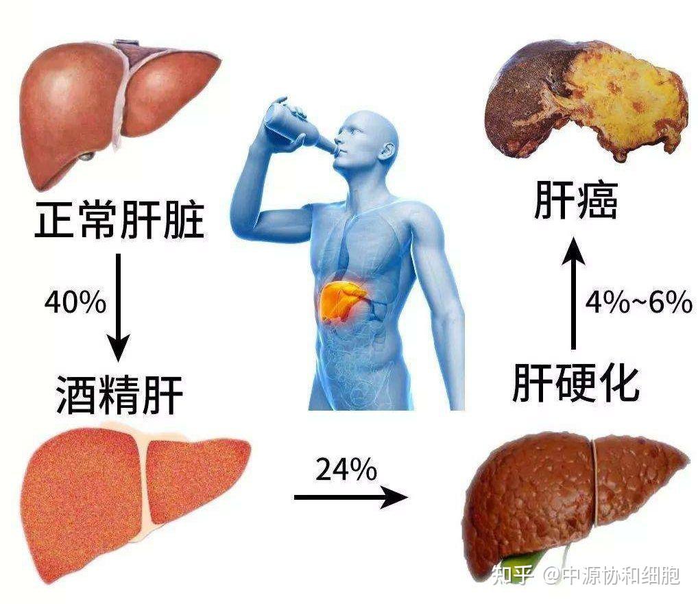 应酬多想喝酒还不想伤肝怎么办