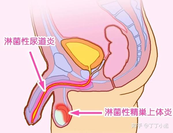 约了不明pa 担心得性病 怎样自查及处理 知乎