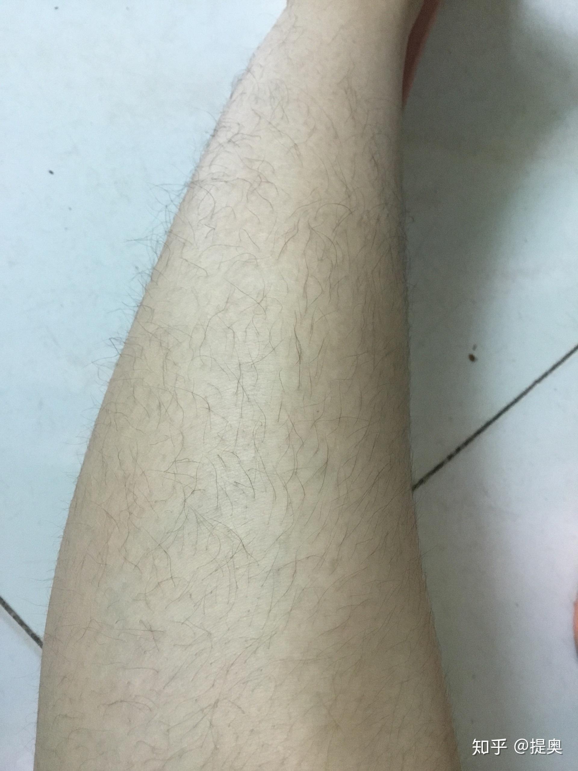 女生汗毛重是怎样的一种体验