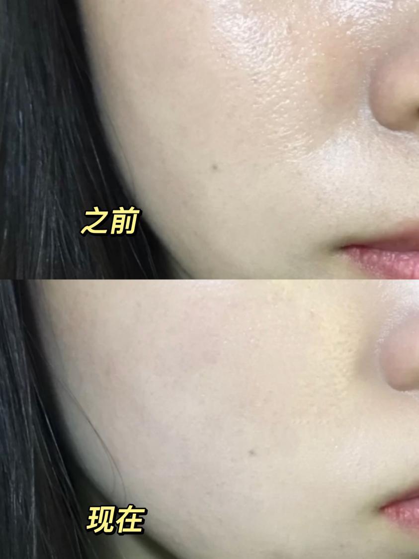 你们试过最牛逼最好用的控油水乳是什么