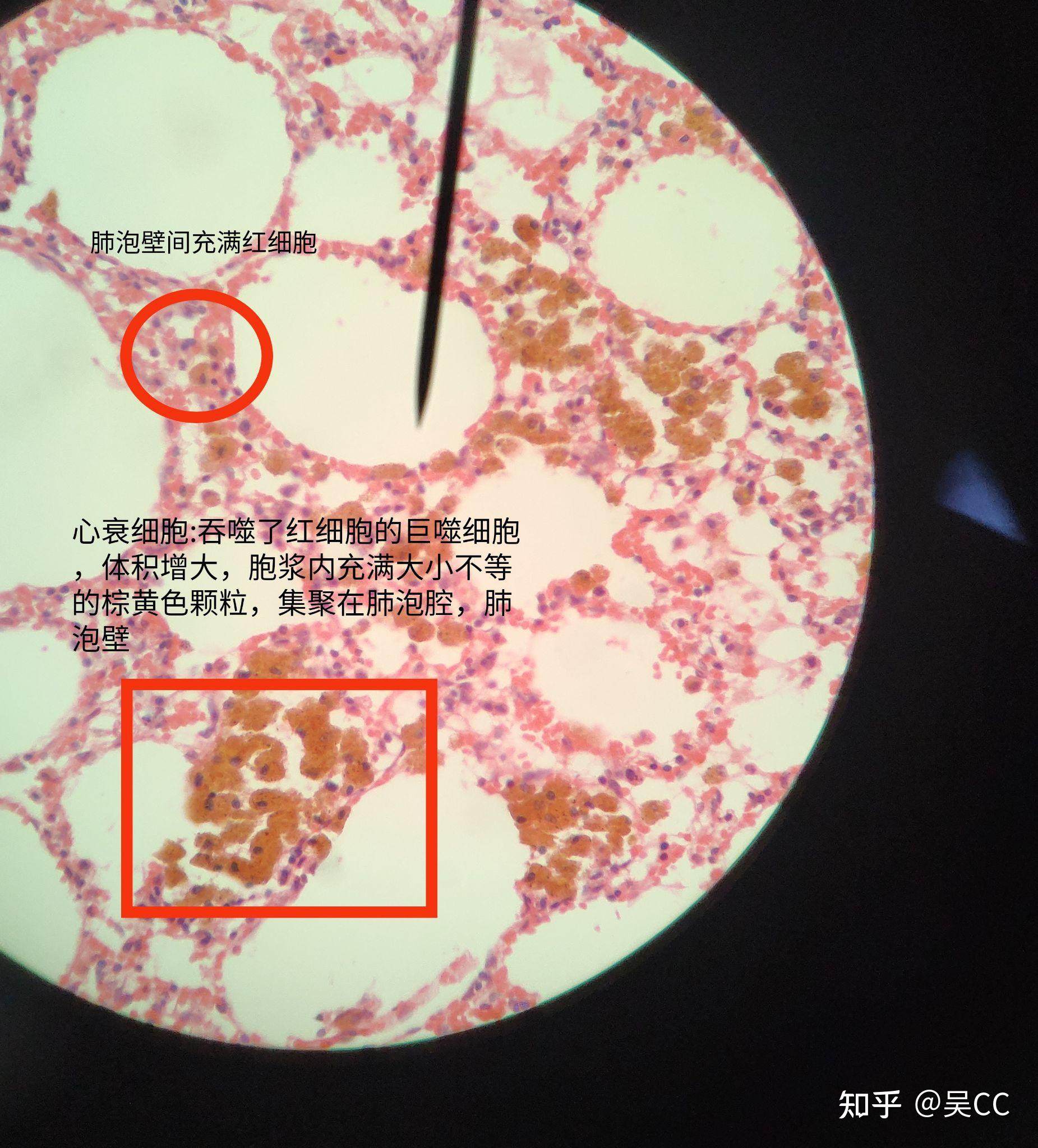 肝索切片图片