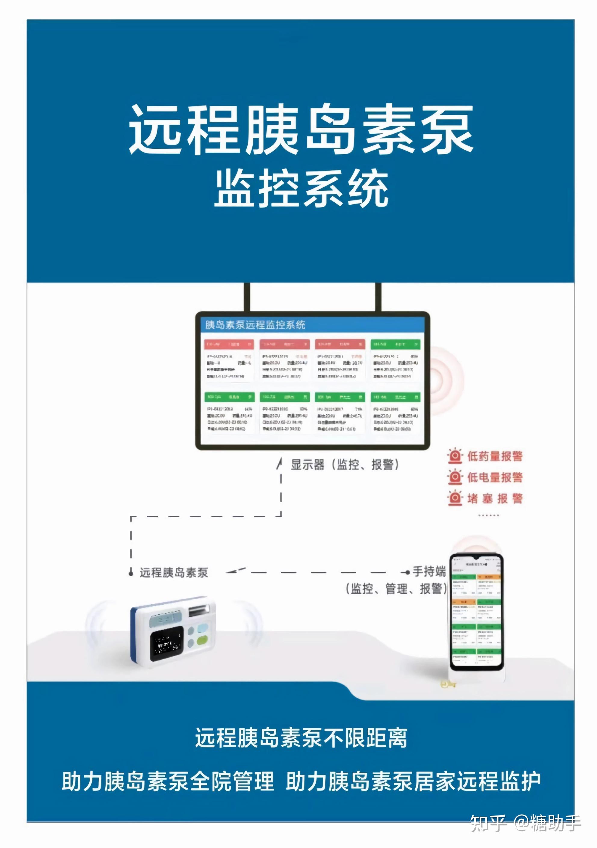 《迈向未来:揭秘迈世通远程监控与闭环胰岛素泵系统》 - 知乎