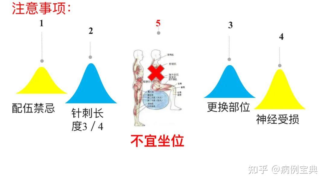 z型注射法