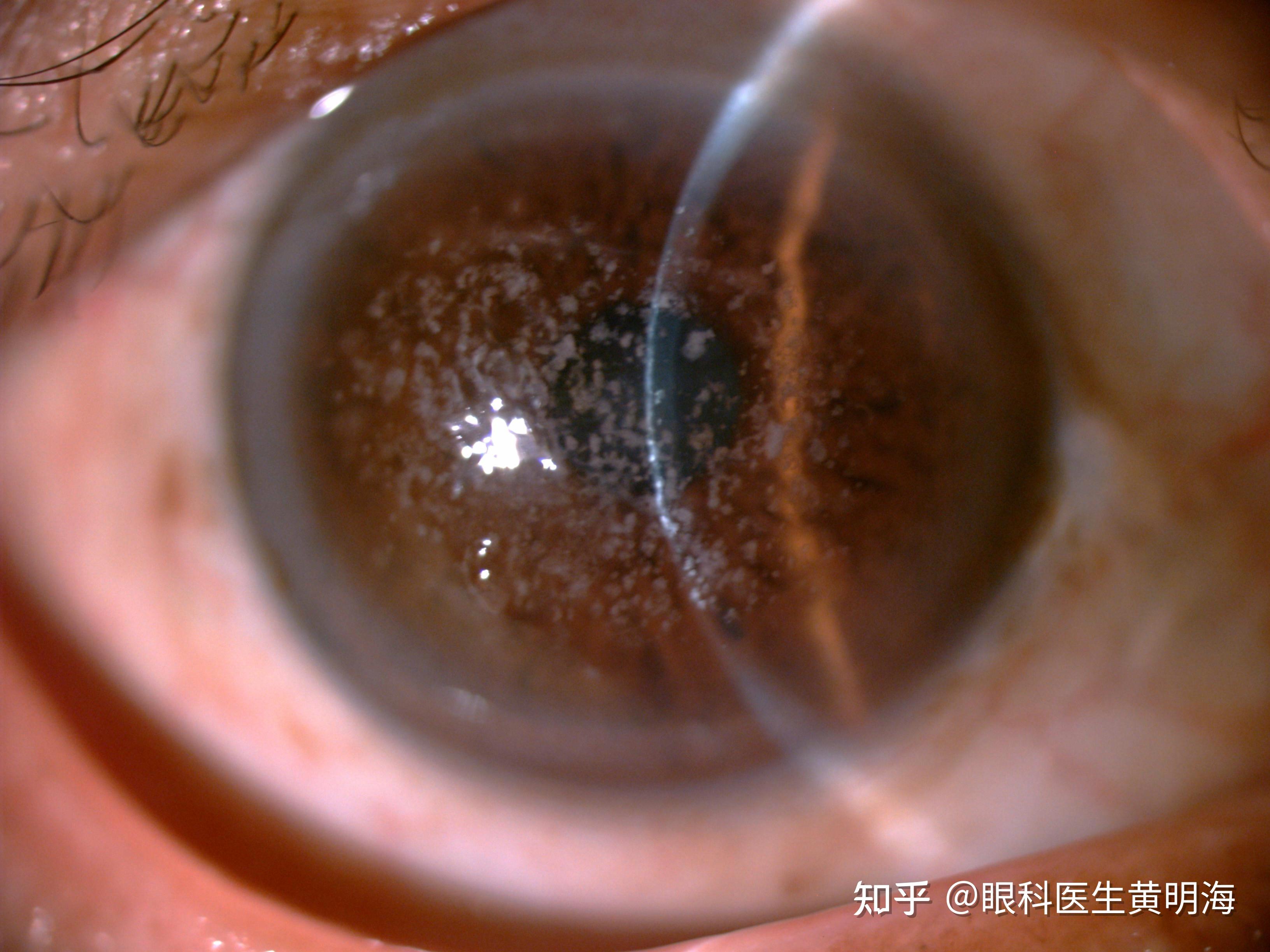 眼睛看不清竟然是营养不良