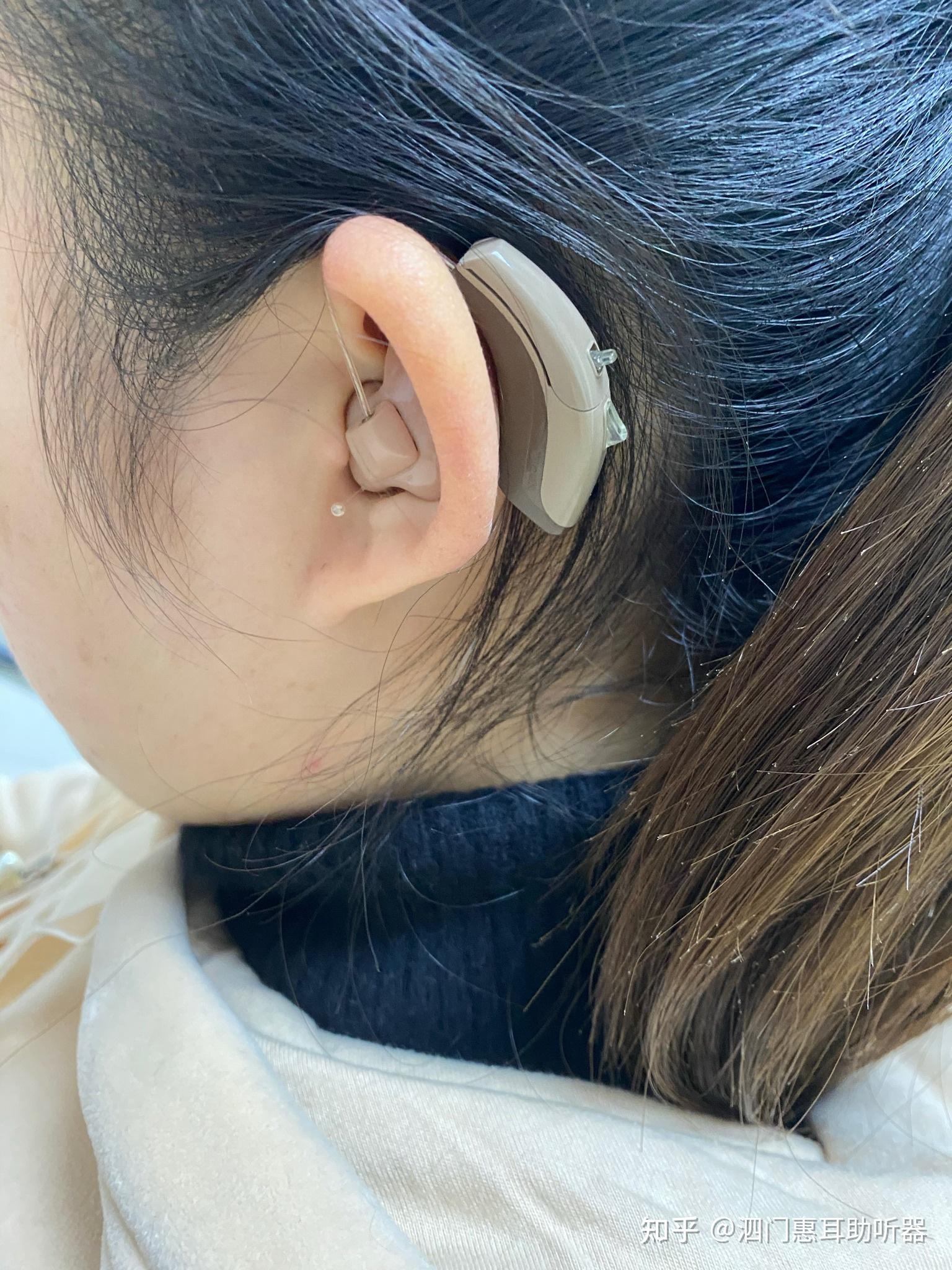 助听器77人工耳蜗双模干预用户