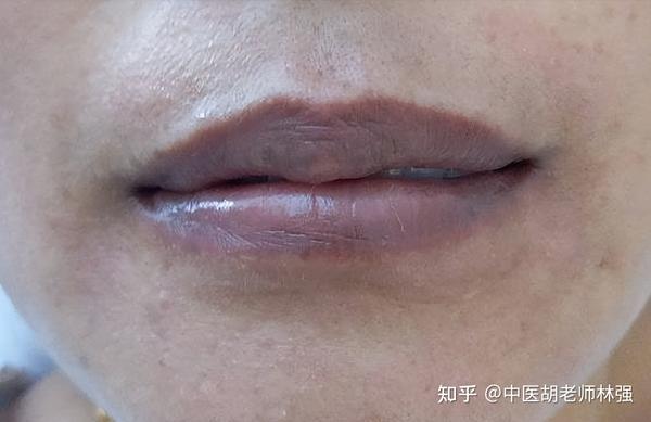 脾胃好不好,看嘴就知道!嘴唇有这4种变化,需要警惕了 - 知乎